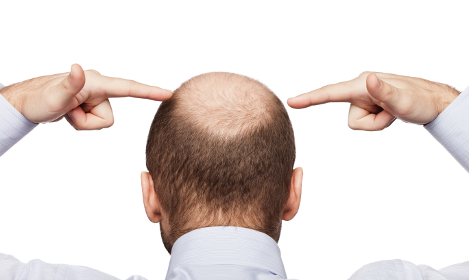 바이오틴 탈모샴푸 추천 효과 (내돈내산 솔직후기)