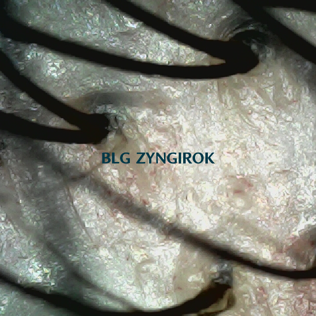 탈모 극복 프로젝트 - 뒷머리 두피 모습이다.