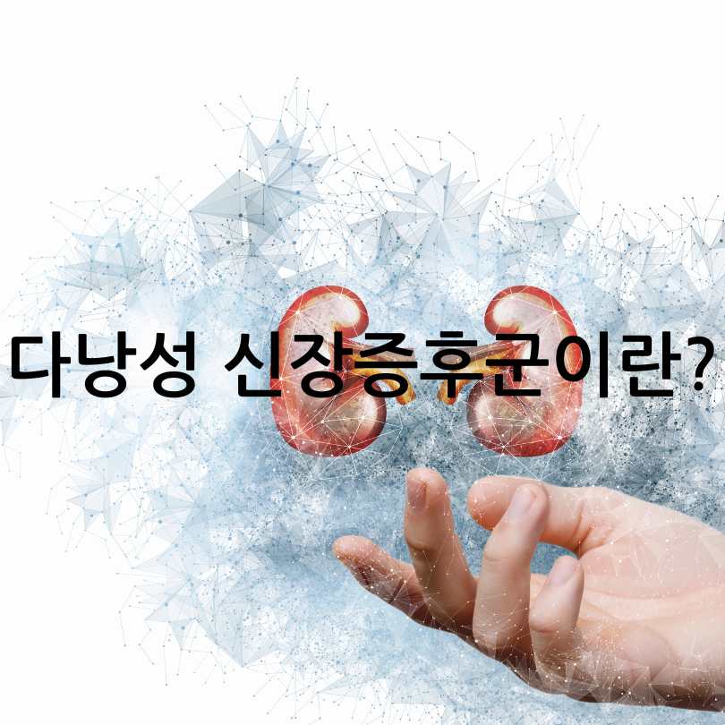 다낭성 신장증후군 증상과 치료법
