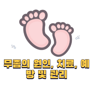 무좀의 원인&#44; 치료&#44; 예방 및 관리