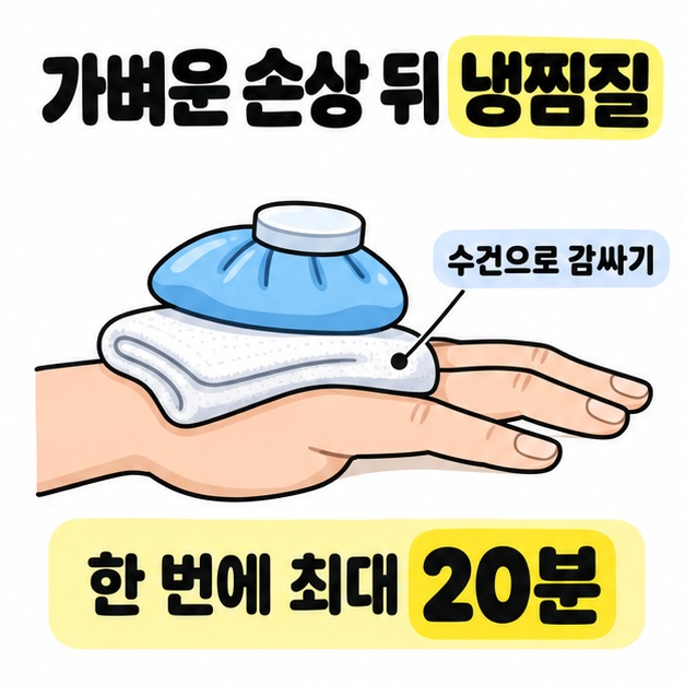 손 위에 수건을 대고 냉찜질팩을 올린 모습과 한 번에 최대 20분이라는 냉찜질 시간을 보여주는 그림