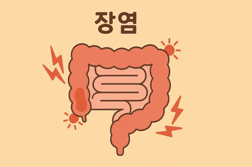 장염 증상