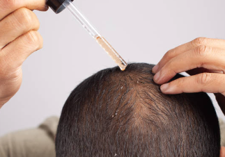 탈모약