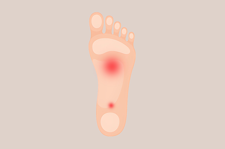 통증의-위치가-변하는-모습