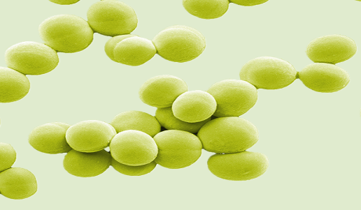 구형세균(황색포도상구균), 나선형세균(캄필로박터균)