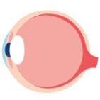 강아지 백내장 원인&#44; 진행단계&#44; 치료