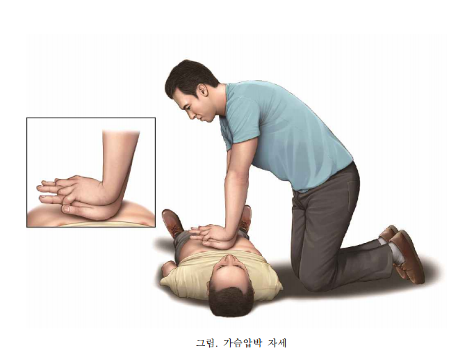 심폐소생술