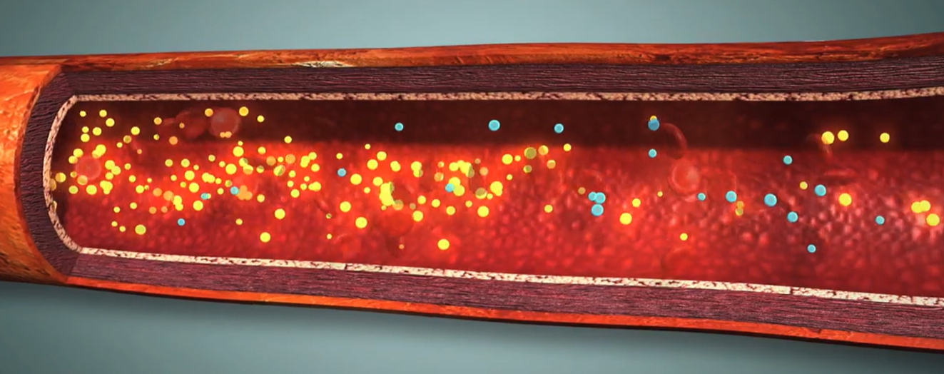 중성지방 정상수치