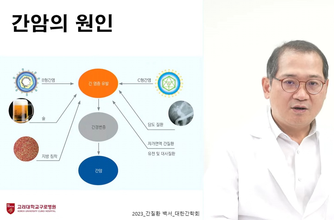 지방간염-김지훈-교수-간암의원인