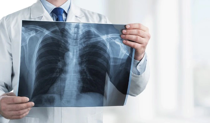 기관지염 증상 9가지