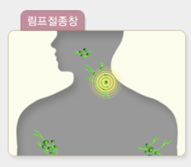성홍열 증상 검사 전염 격리기간 총정리