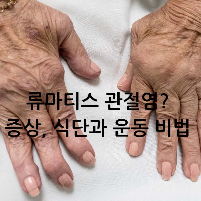 류마티스관절염 증상,식단,운동법