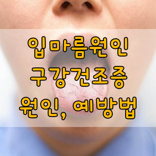 입마름원인&#44; 구강건조증 원인과 예방법 총정리!