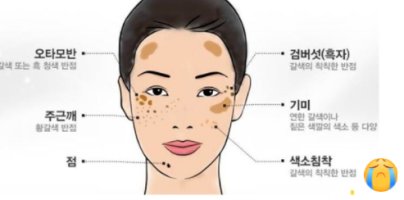 도란사민