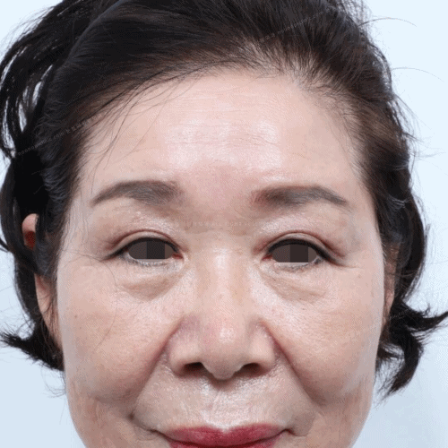 60대이마거상
