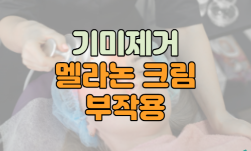기미제거-멜라논크림-부작용