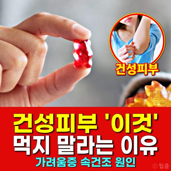 건성피부 관리,건성피부 가려움증,건성피부에 안 좋은 음식,팁줌