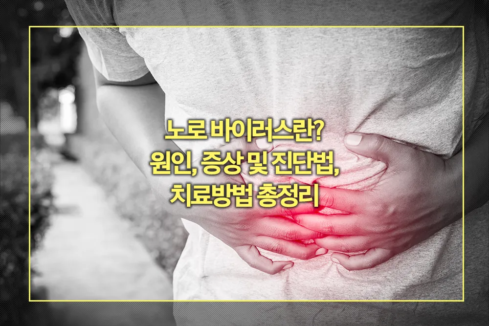 노로 바이러스 원인, 증상 진단법, 치료방법