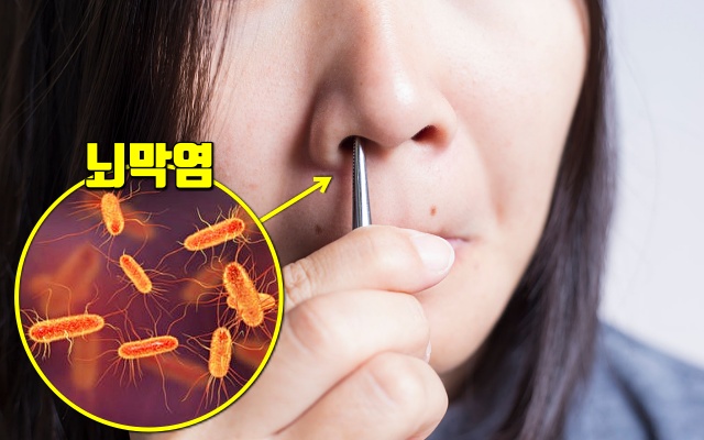 코털 콧털 눈썹 길게 나는 이유,뇌막염 퍠혈증,건강