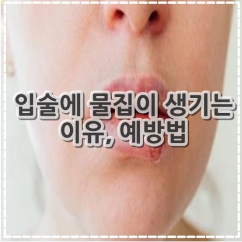 입술에 물집이 생기는 이유, 예방법 정리