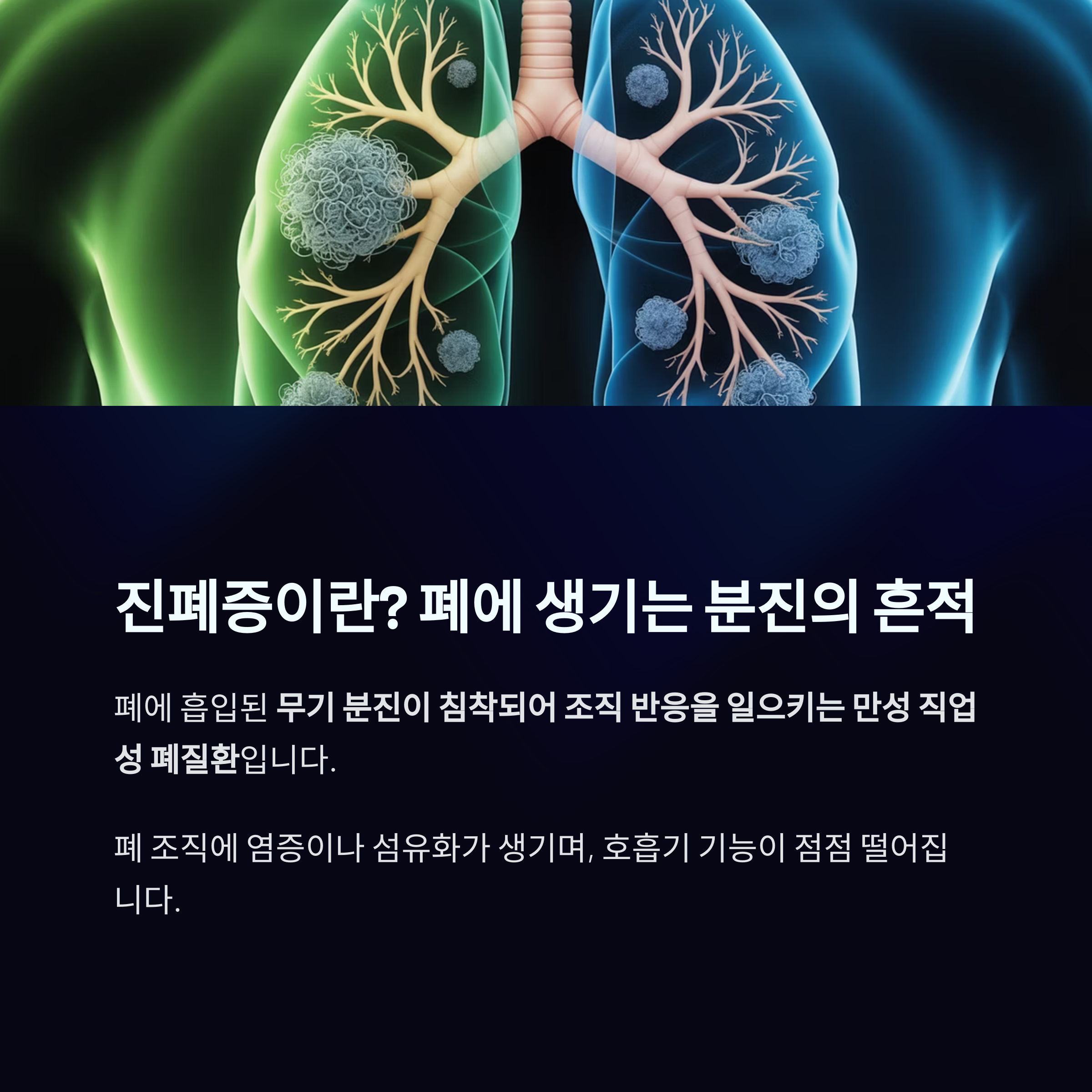 양쪽 폐 내부에 무기 분진이 침착된 모습을 보여주며 진폐증의 정의와 폐 조직 손상을 설명하는 인포그래픽