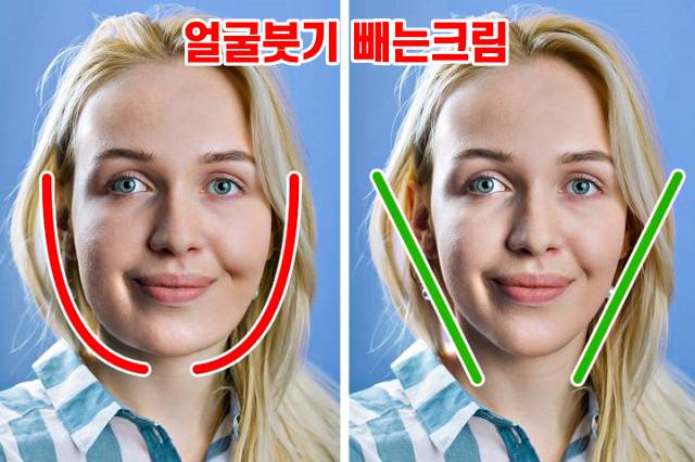 얼굴붓기 빨리 빼는법,얼굴붓기빼는법,얼굴붓기빼는 비타민K 크림