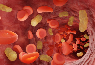 아데노 바이러스