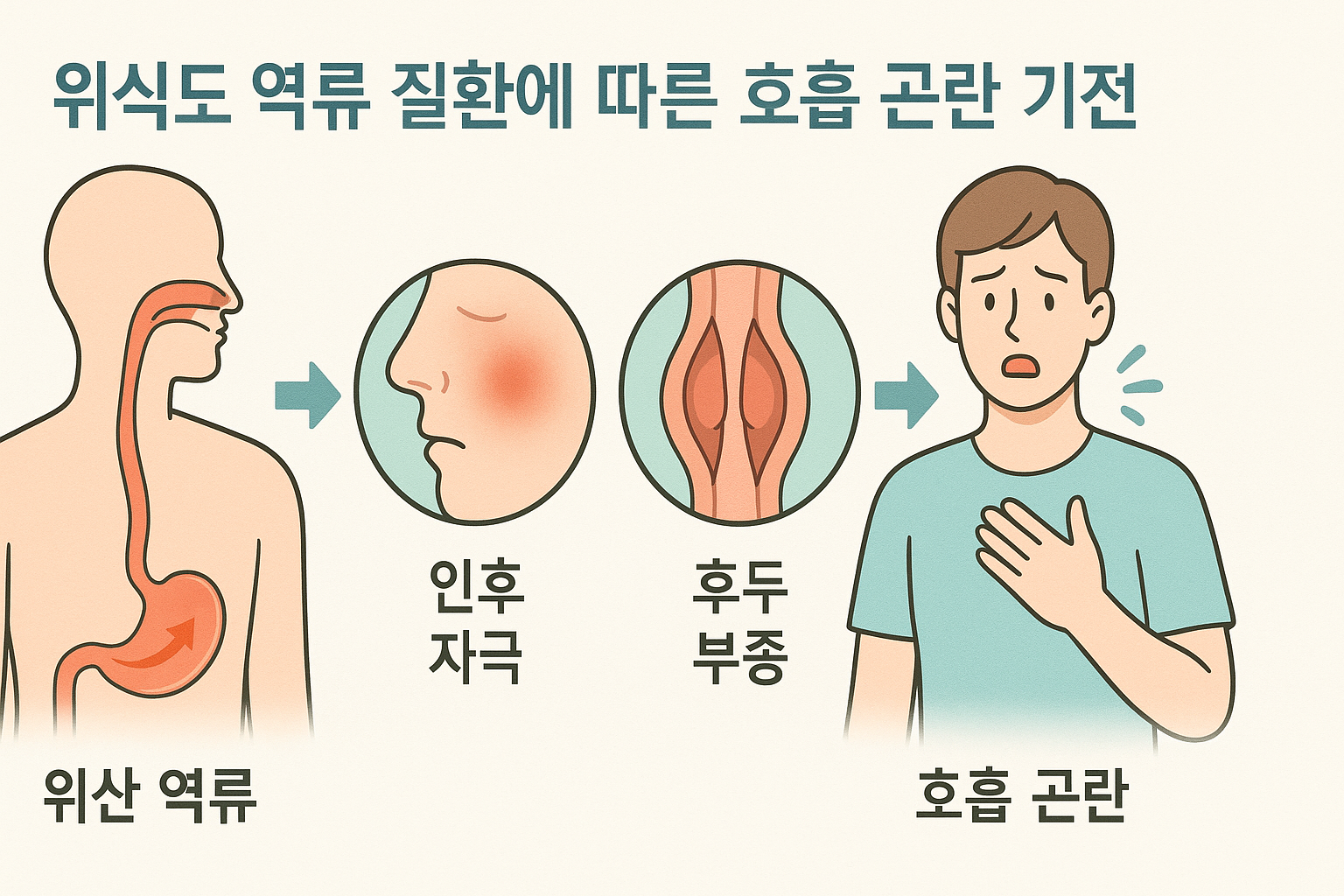 역류성 식도염 증상 호흡곤란, 방치하면 더 위험합니다