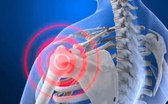 관절 영양제 추천&amp;#44; 관절 영양제 고를 때 주의사항