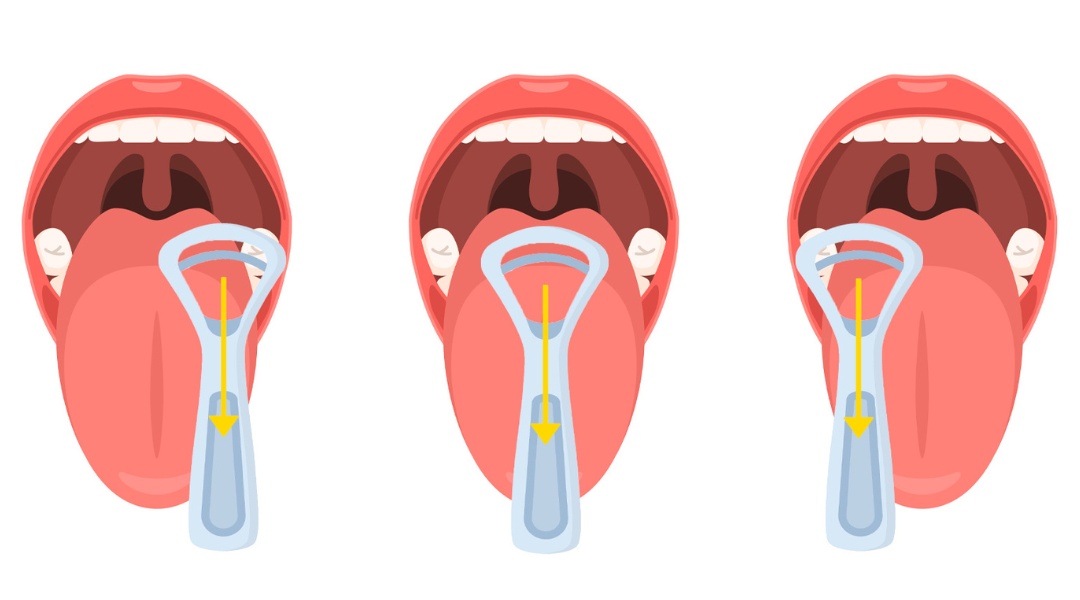 혀 클리너 사용법