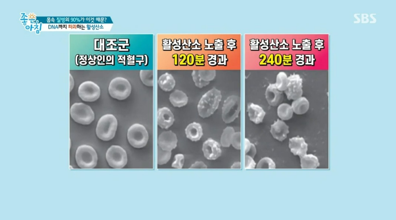숨만 쉬어도 활성 산소가 생긴다?