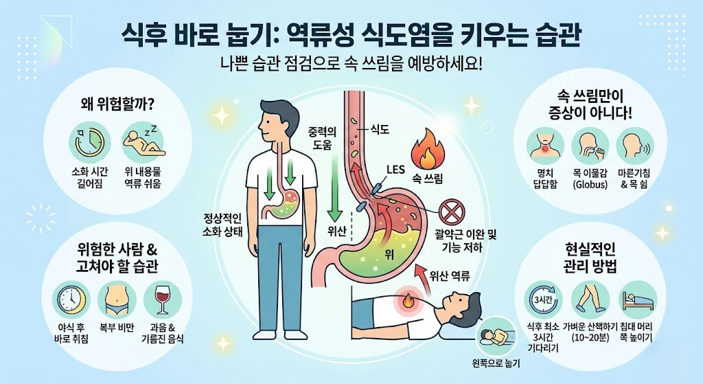 식후 바로 눕는 습관, 속쓰림과 역류성 식도염을 부르는 이유