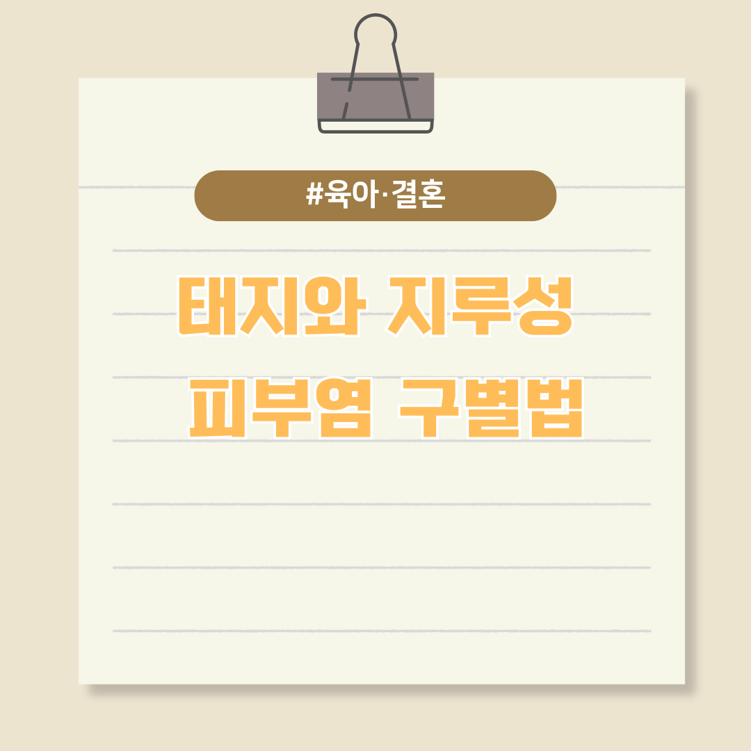 태지와 지루성 피부염 구별법