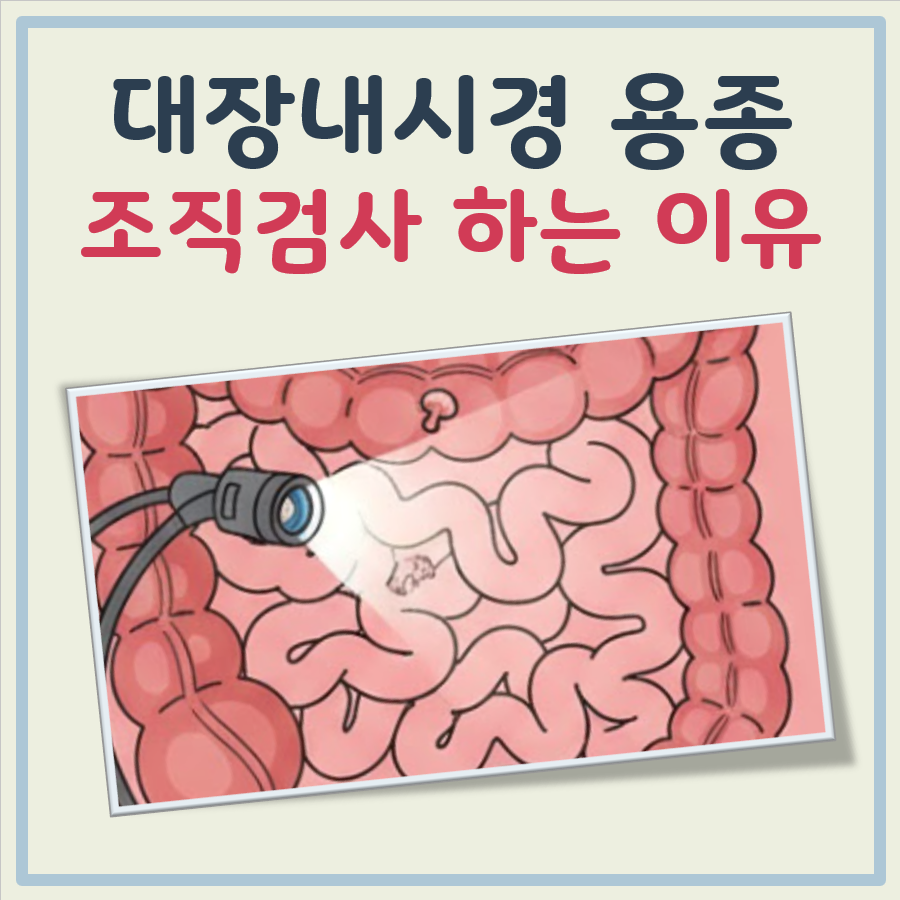 대장내시경 용종 조직검사 하는 이유 대표 이미지