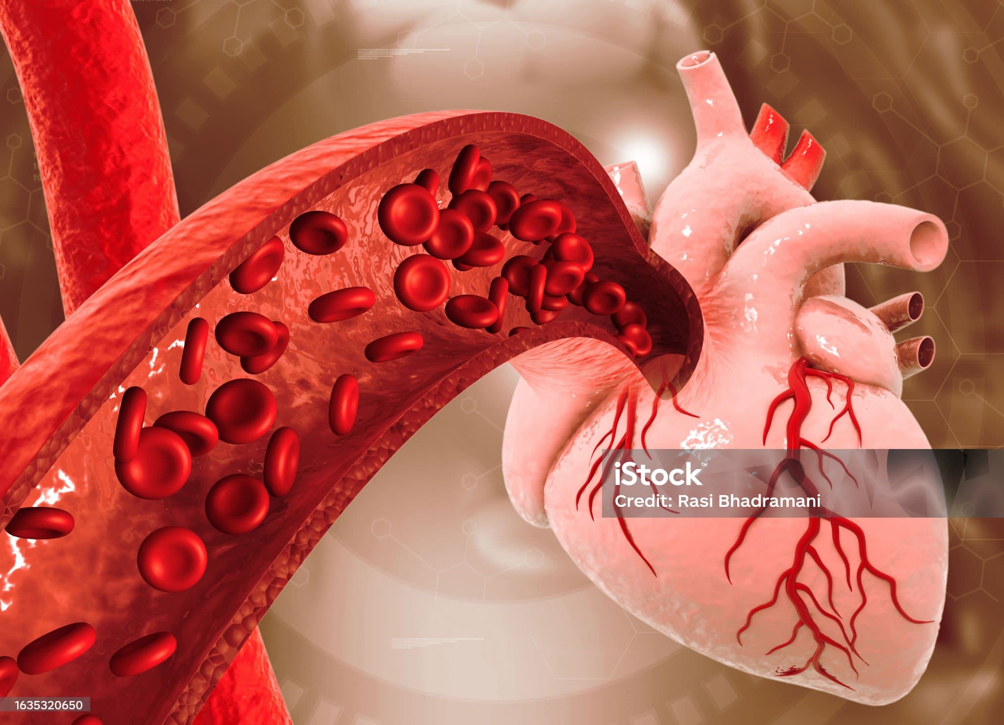 LDL콜레스테롤 수치 낮추기