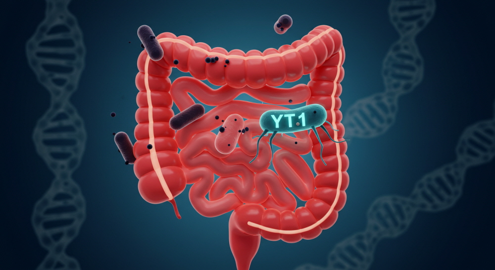 갱년기 유산균 YT1
