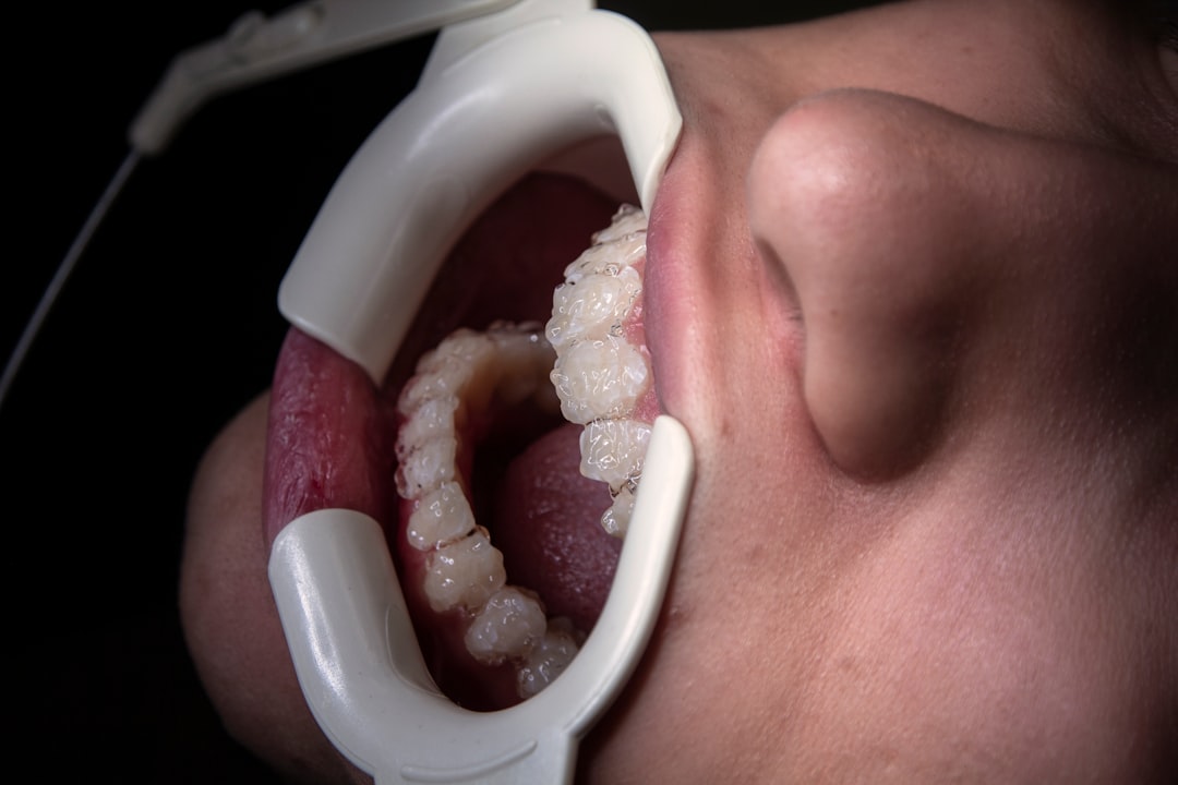 Dental insurance