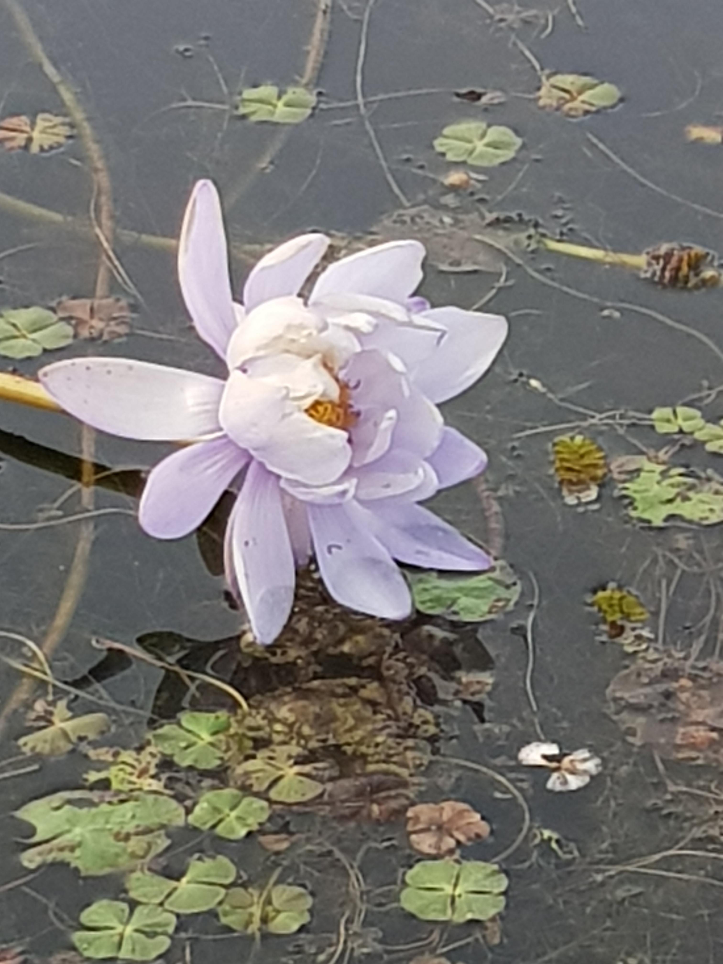 갑상선 기능저하증 초기증상 7가지 총정리(검사비용 포함)