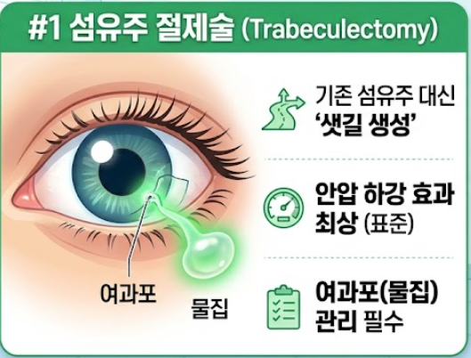녹내장 수술