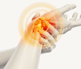 손목터널증후군