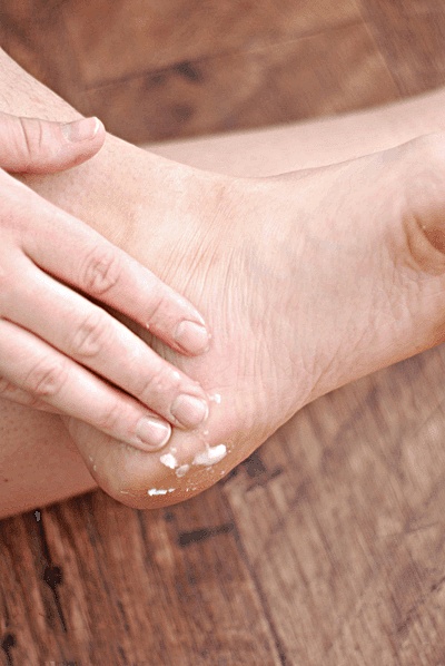 발뒤꿈치 각질제거 갈라짐,뒤꿈치 굳은살 제거,레몬껍질,풋크림