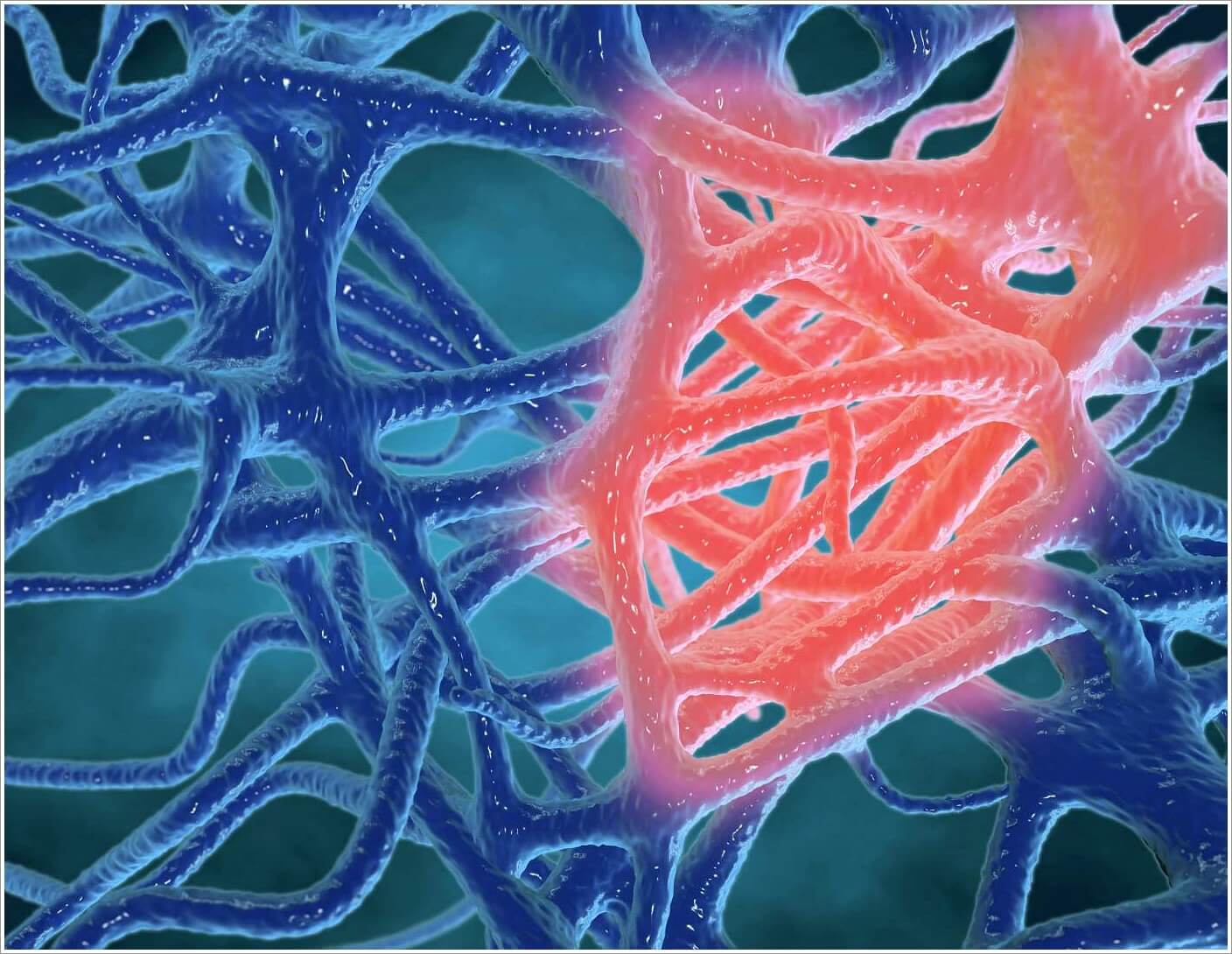 염증에 좋은 음식과 나쁜 음식