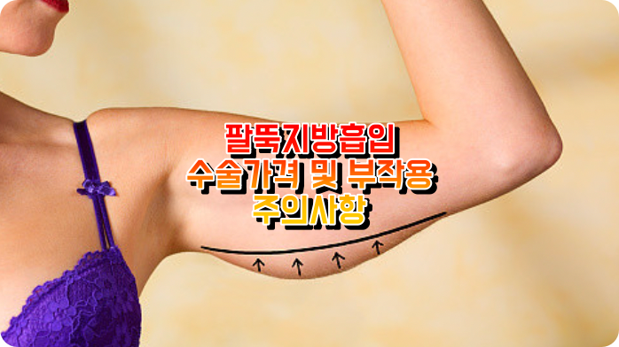 지방흡입수술
