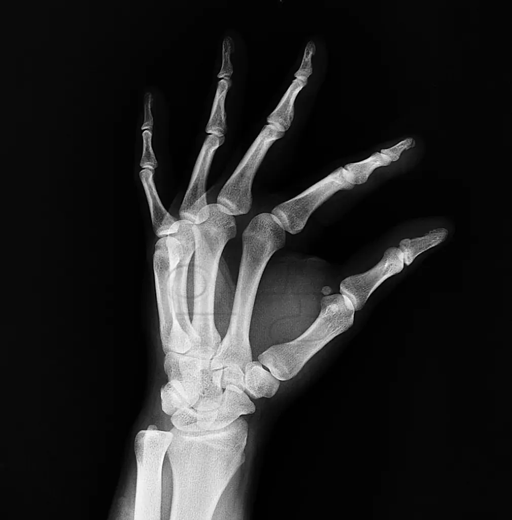 바나바잎 효능 중 뼈 건강 관련 사진