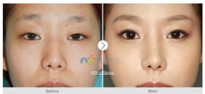 영원한 콩밥 '계곡 살인' 이은해 프로필 총정리