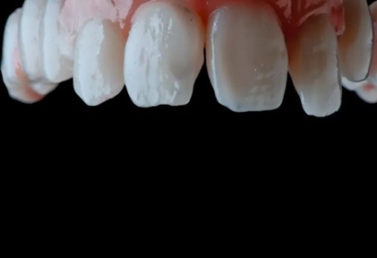 이빨 흔들리는 꿈