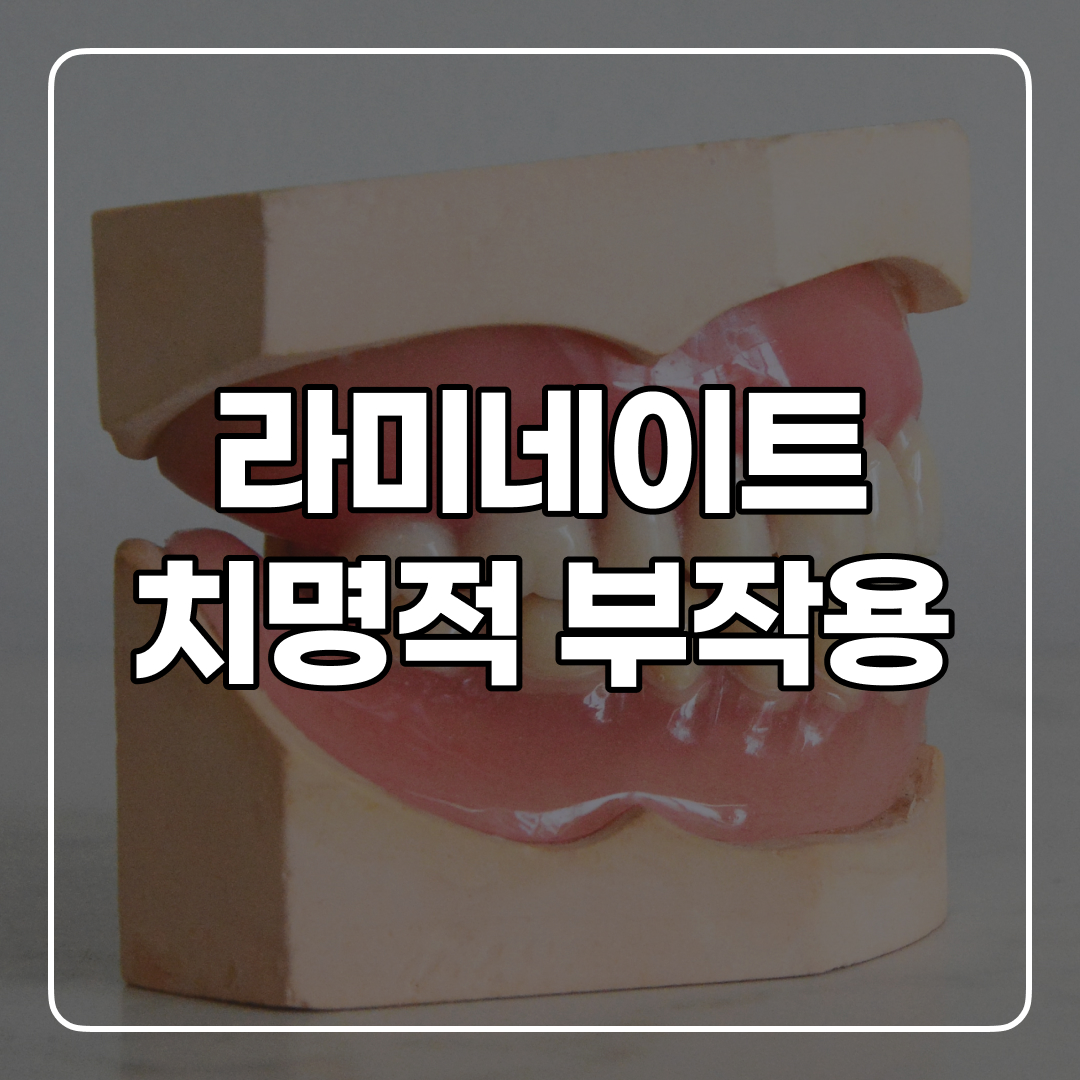 라미네이트 부작용