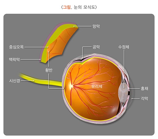 당뇨망막병증