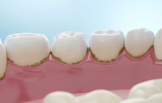 스케일링 이미지/출처:어도비스톡