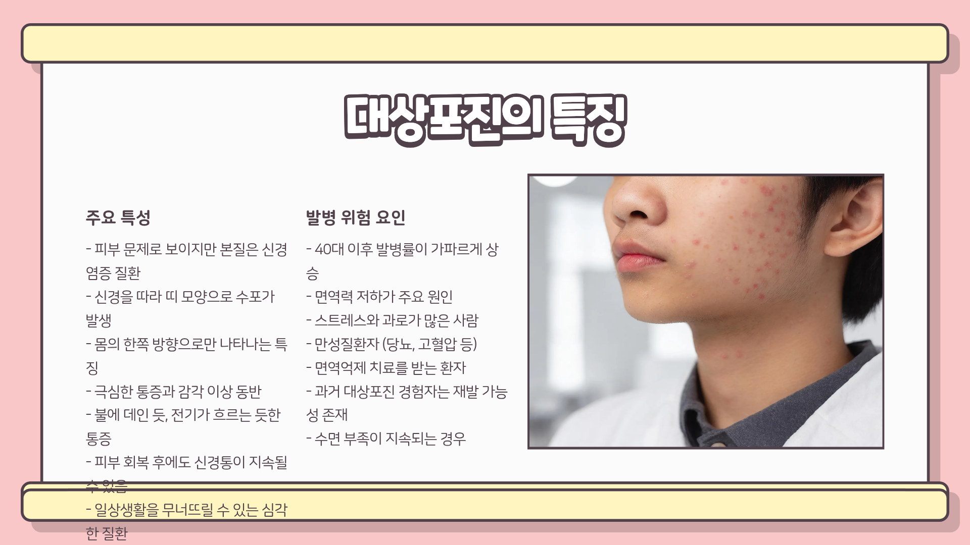 대상포진 예방접종 ❘ 대상포진 전조증상 ❘ 대상포진 치료방법, 안 하면 후회한다